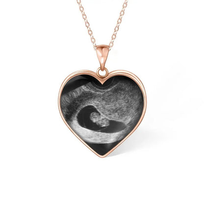 Baby Remembrance Necklace with Heart Shaped Ultrasound Image - United Bracelets